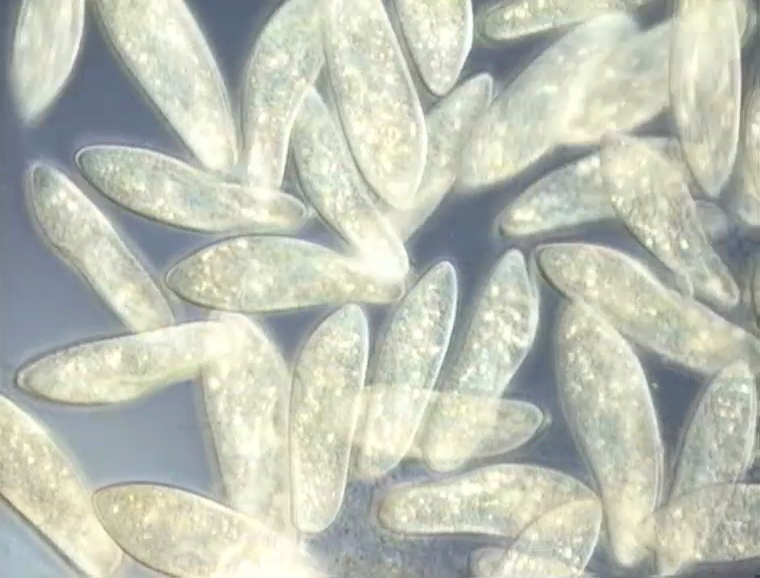 Einzeller - Wimpertiere und Wurzelfüßer